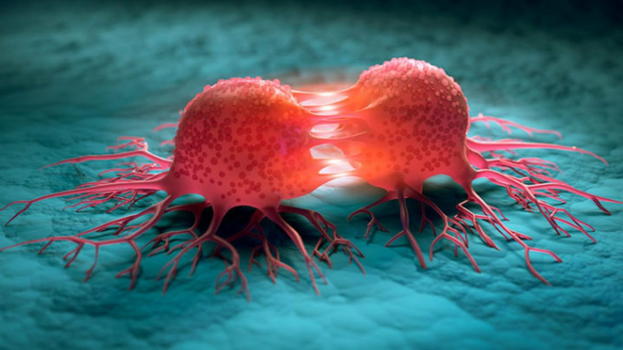 Claudia Adamo, neoplasia: cos’è e quali sono i sintomi