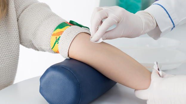 Esame ematico  che rileva 12 neoplasie prima dei sintomi