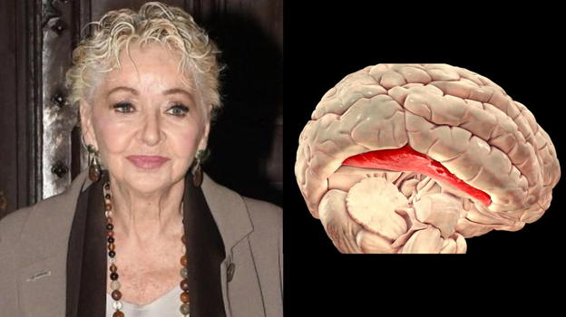 Prosopagnosia, la malattia che ha colpito Enrica Bonaccorti: ecco i sintomi a cui fare attenzione