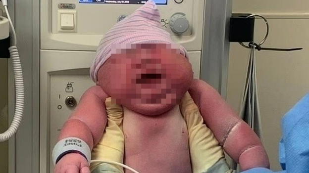 Neonato record, la mamma: "Non pensavo di farcela, ecco quanto pesa"
