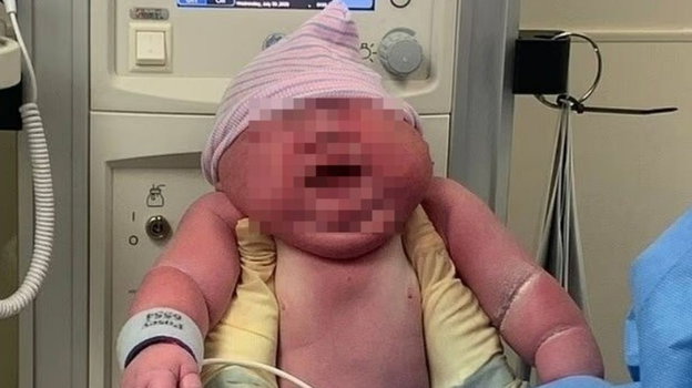 Neonato record, la mamma: "Non pensavo di farcela, ecco quanto pesa"