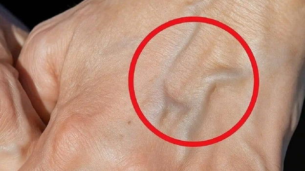 Vene visibili: cosa significano e perché potresti vederle