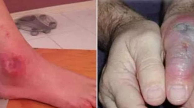 È pericoloso, ecco gli alimenti da evitare: rischio altissimo