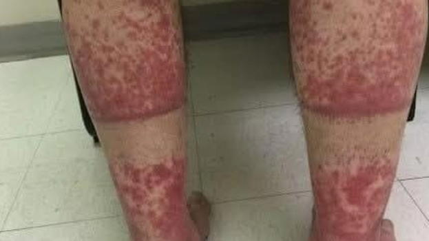 Attenzione: ecco le conseguenze del dormire con…