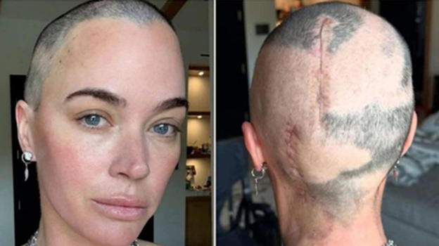 Il cantante svela come la figlia si sia accorta della neoplasia al cervello