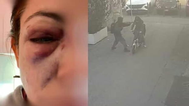 Presa a pugni da uno sconosciuto mentre è in bici col figlio, il racconto