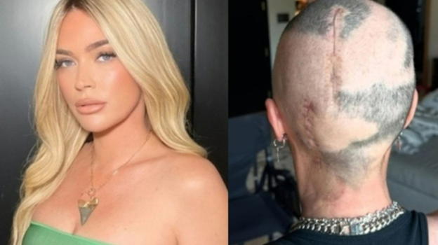 "Mi ha salvato, ecco come mi ha spinto a fare un controllo" Aveva una neoplasia al cervello